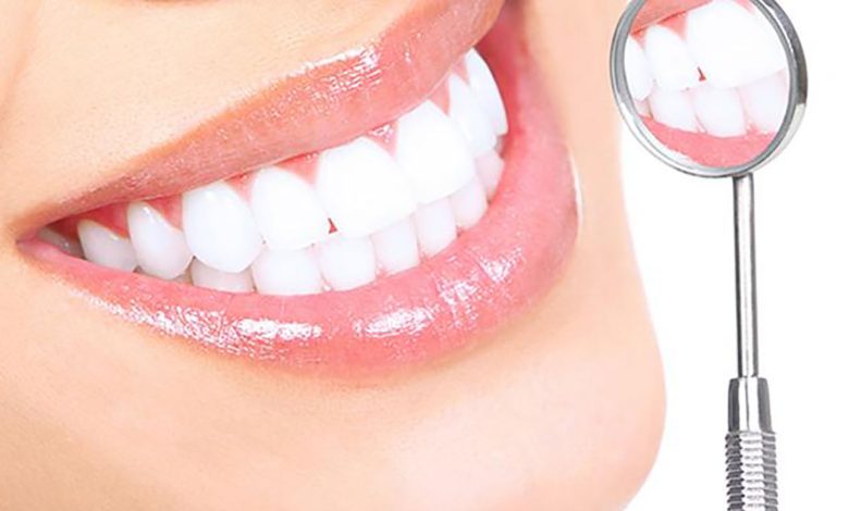 زراعة الاسنان في الاردن كم تكلف