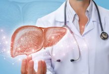 تجربتي مع ارتفاع انزيمات الكبد