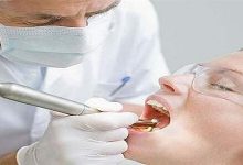 تفسير رؤية الذهاب لطبيب الأسنان