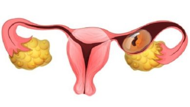 كيف اعرف ان الحمل خارج الرحم