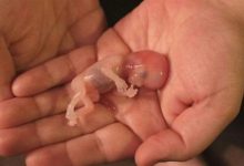 كيف اعرف ان الرحم نظيف بعد الإجهاض عالم حواء