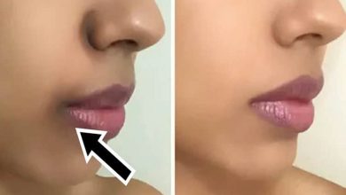 تجربتي في ازالة سواد الشفايف